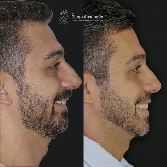 473448015_18483781129052301_4965989613092144805_n