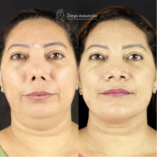 diegoassuncao.buco_1761258552344