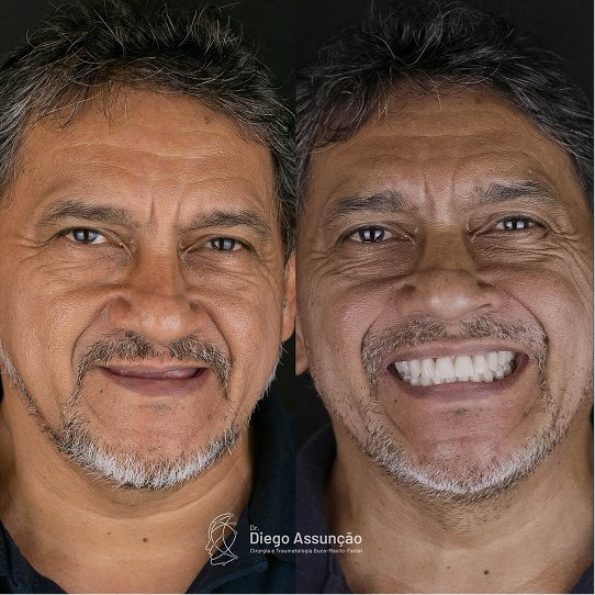 diegoassuncao.buco_1761300331523