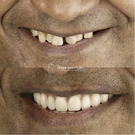 diegoassuncao.buco_1761300701380