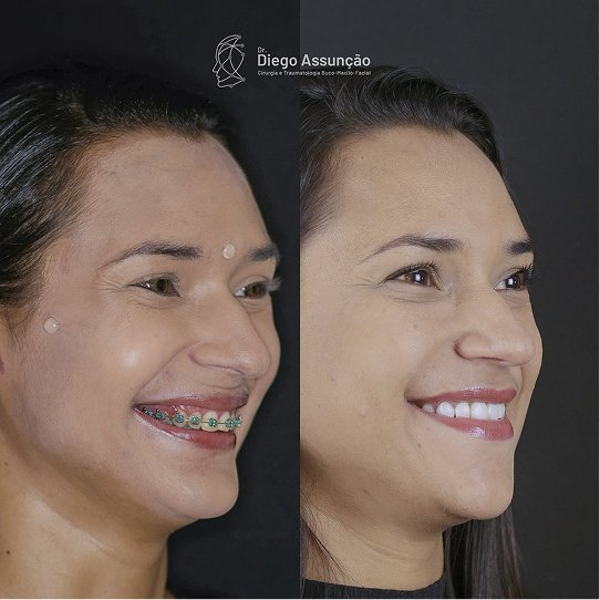 diegoassuncao.buco_1762524501492