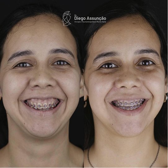 diegoassuncao.buco_1762524763105 1