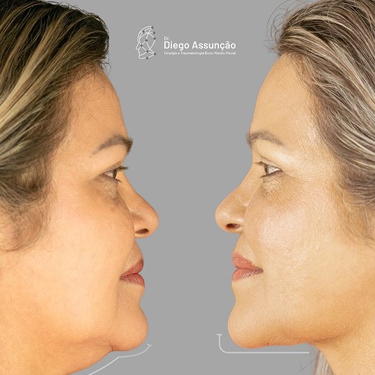 diegoassuncao.buco_1763156036987 1