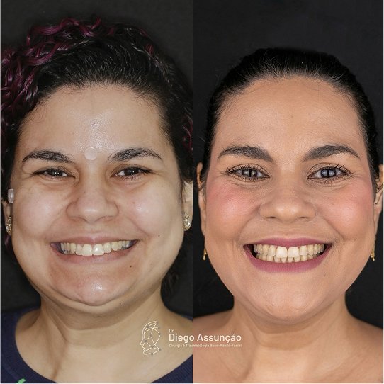 diegoassuncao.buco_1763156321272