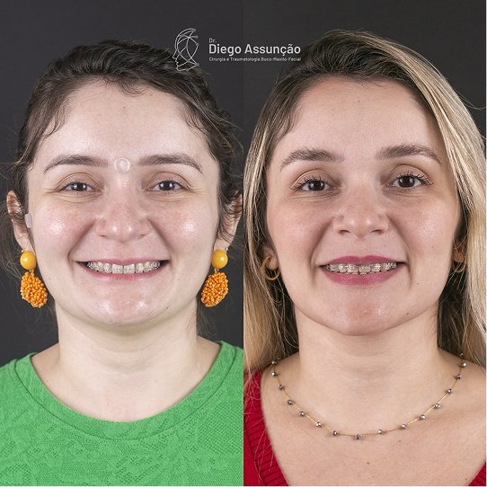 diegoassuncao.buco_1763156335464