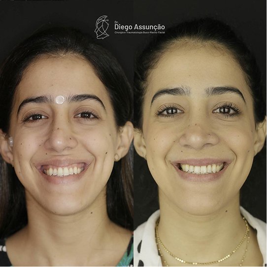 diegoassuncao.buco_1763156355975