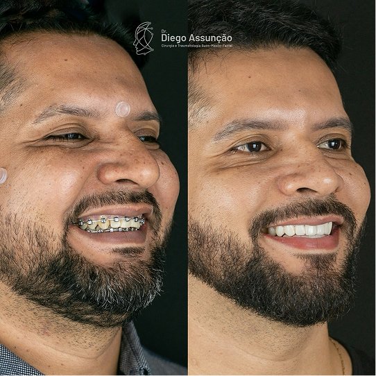 diegoassuncao.buco_1763159143451 1