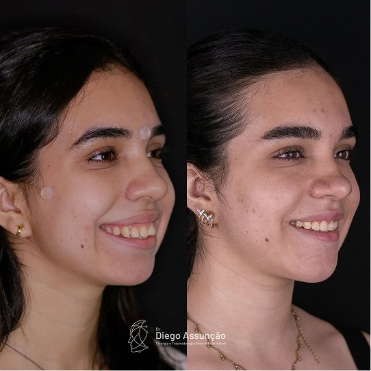 diegoassuncao.buco_1763159203107 1