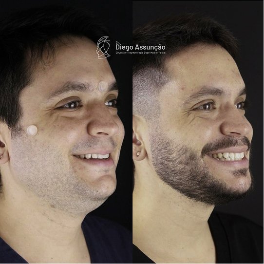 diegoassuncao.buco_1763160199744