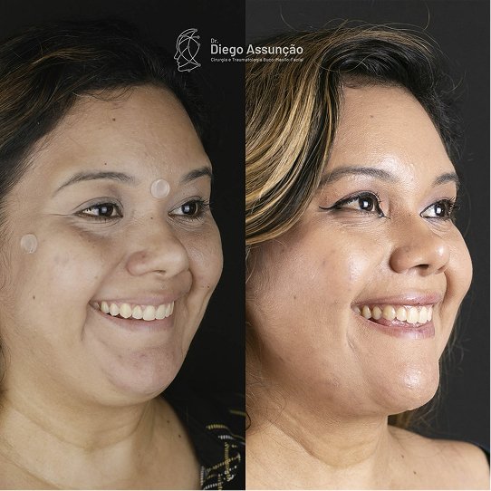 diegoassuncao.buco_1763160719040