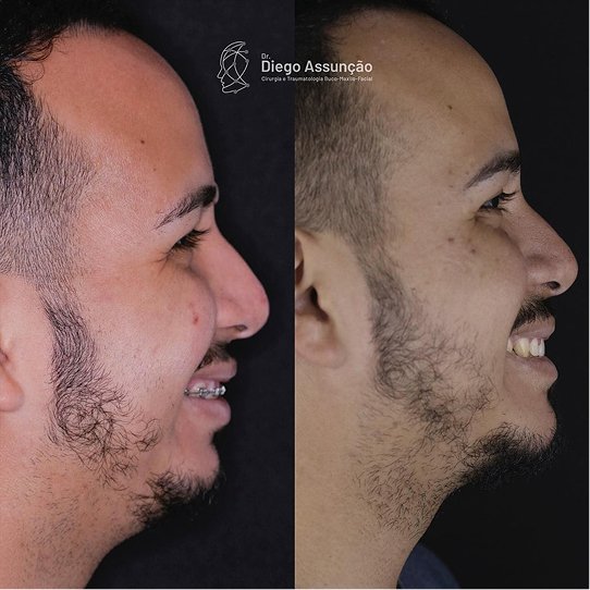 diegoassuncao.buco_1763160888529 1