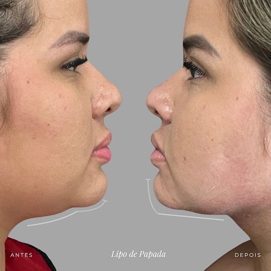 diegoassuncao.buco_1768389972059 1