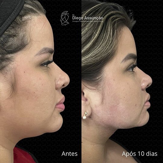 diegoassuncao.buco_1768390046297 1