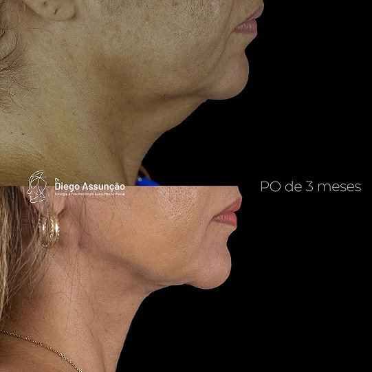 diegoassuncao.buco_1768390059961 1