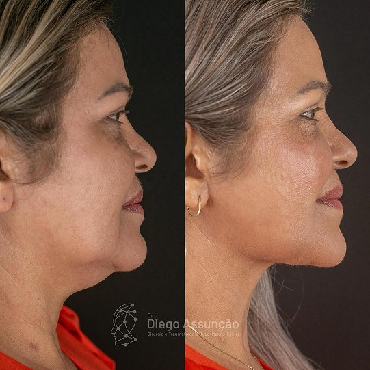 diegoassuncao.buco_1768390104931 1